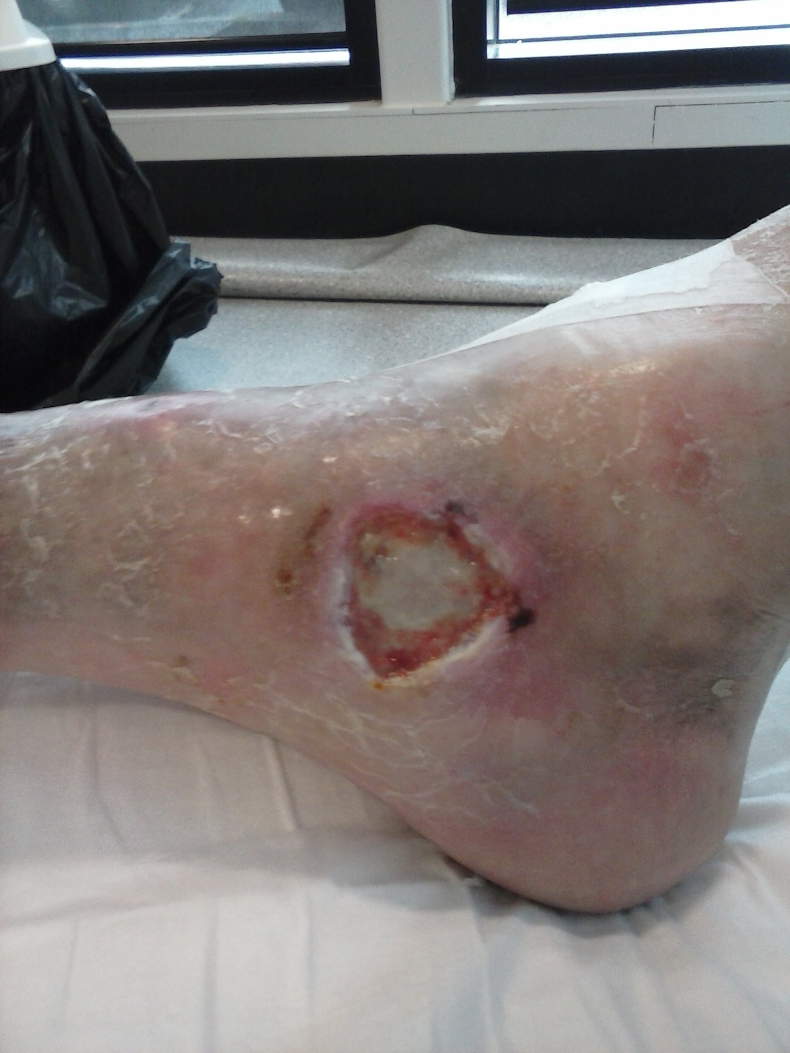 medial right foot 19.9.13.jpg