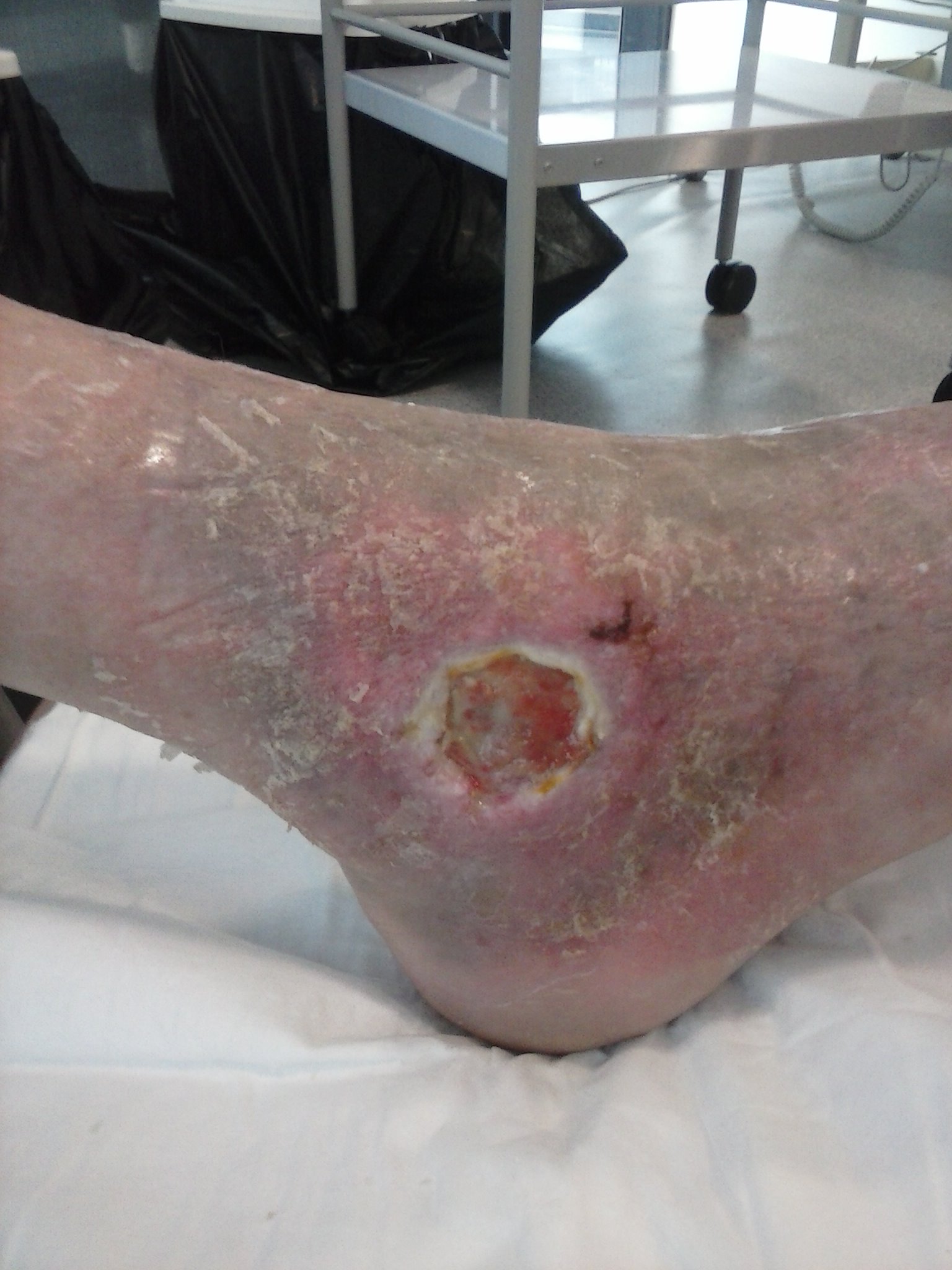 Lateral right foot 19.9.13.jpg