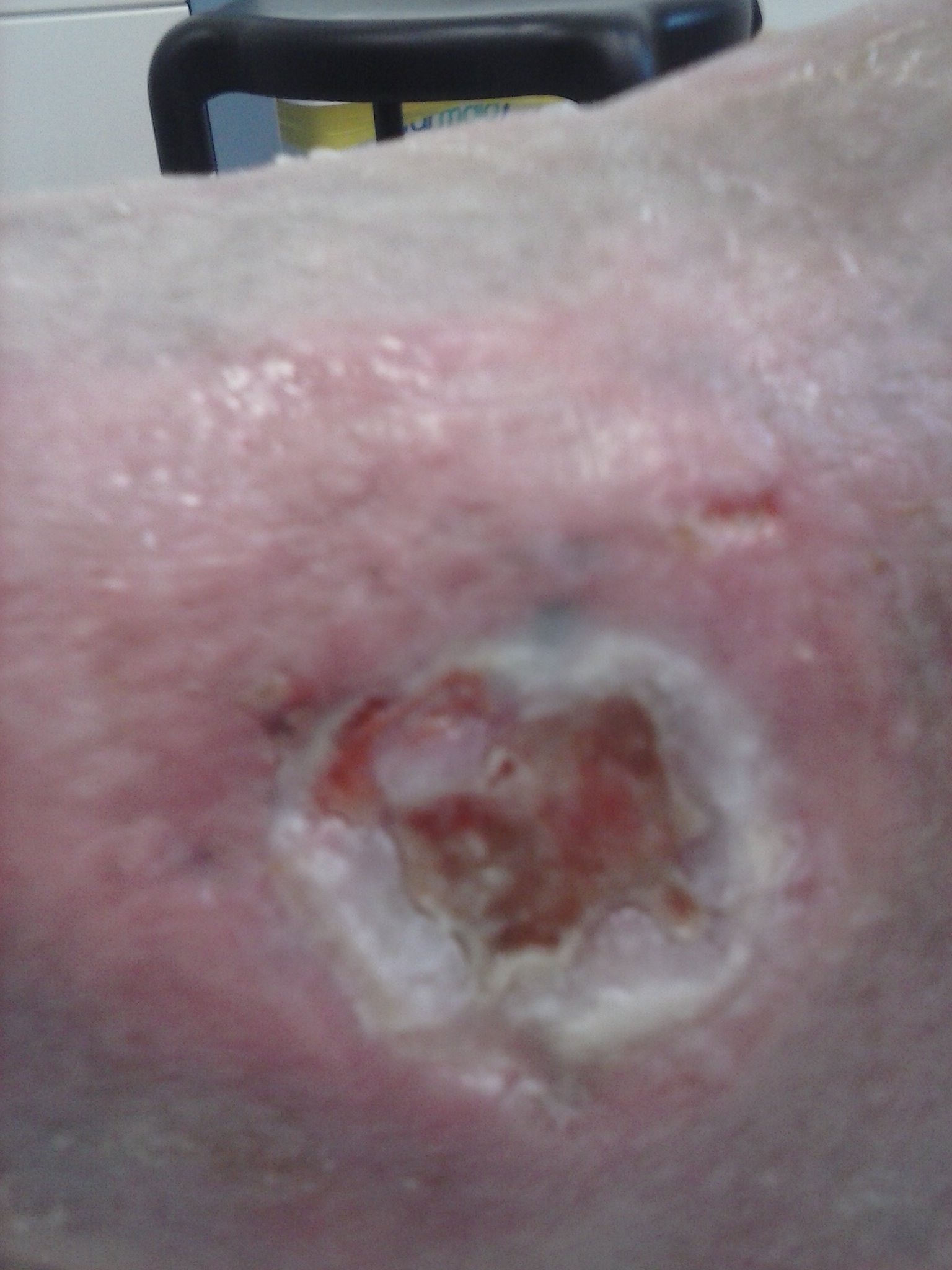 lateral ankle 14.11.13.jpg