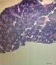 THYMUS before vax.jpg