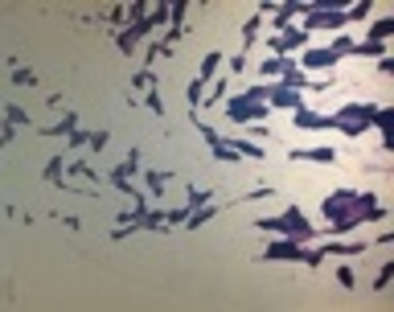 THYMUS after vax.jpg